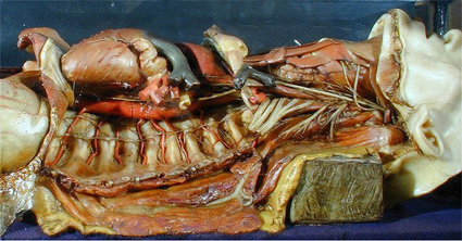 Anatomical Wax Models