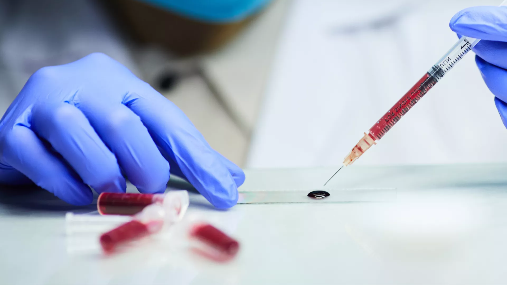 blood test anti-doping flipped
