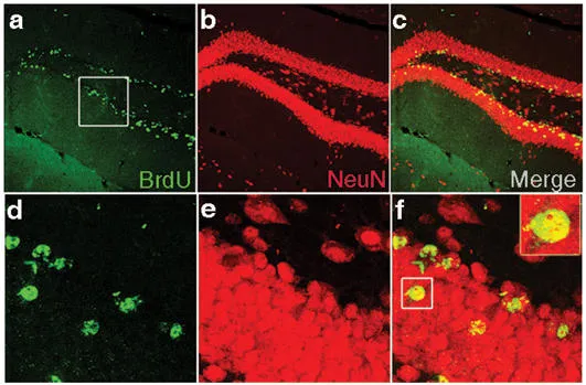 Detection of proliferation and neurogenesis in the dentate gyrus of C57BL/6 mice