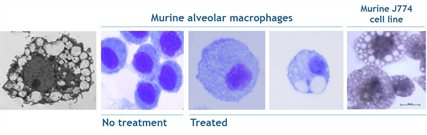 King S College London Foamy Macrophage Assays