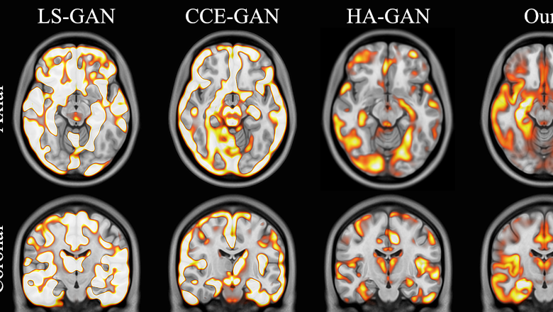 An AI model developed by King's scientists, in close collaboration with University College London, has produced three-dimensional, synthetic imag