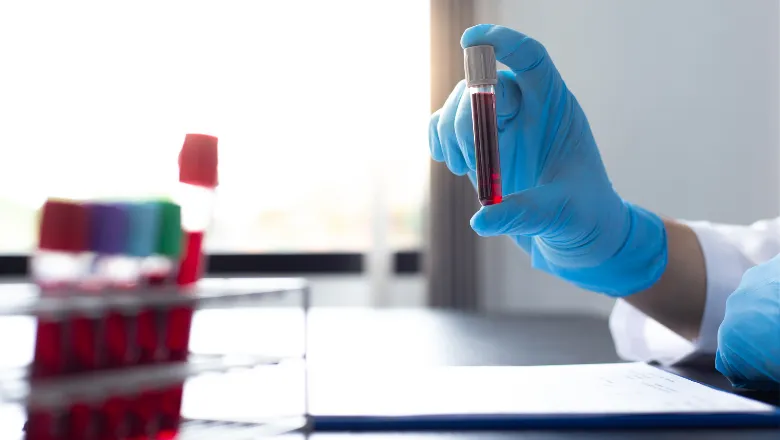 Blood samples for laboratory test