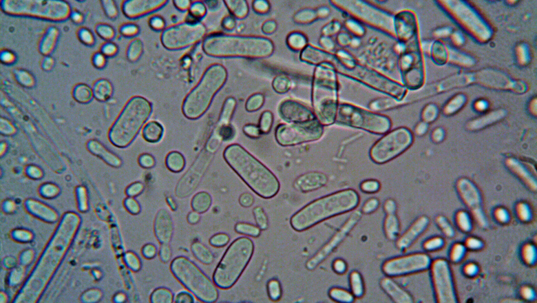 Microorganisms under a microscope