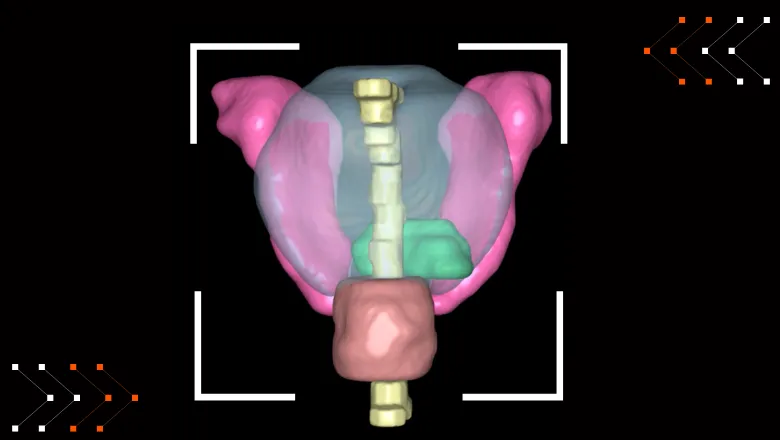 3D model of a prostate