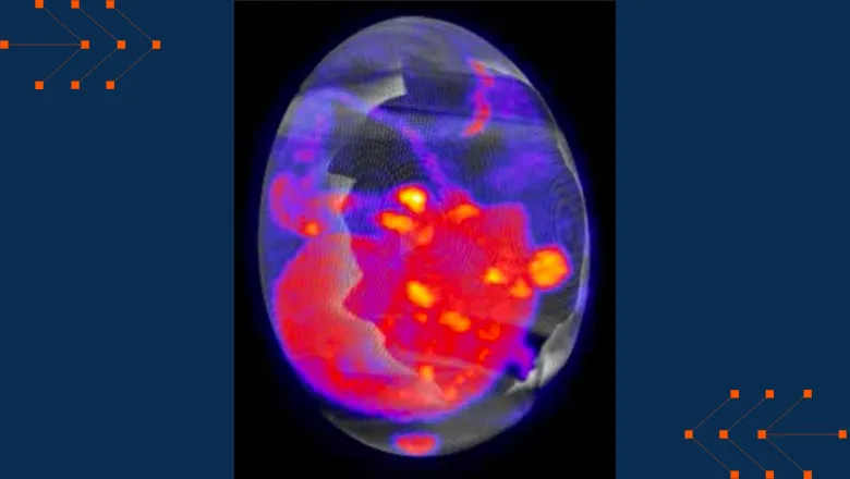 egg membrane containing a tumour