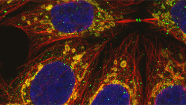 Lipids and Membranes Research Interest Group