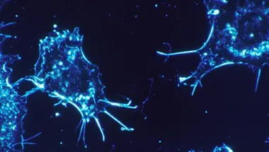 inflammation-biology-hero banner 1903 x558