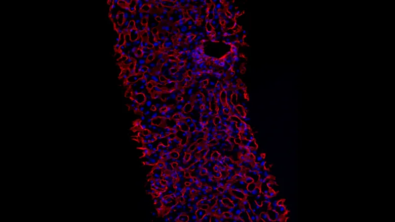 Liver slice with fluorescent ECM staining - credit, Palma Lab, RW-ILS