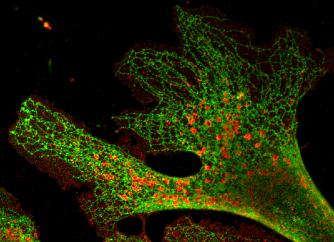 Endoplasmic Reticulum Biochemistry Medbullets Step 1