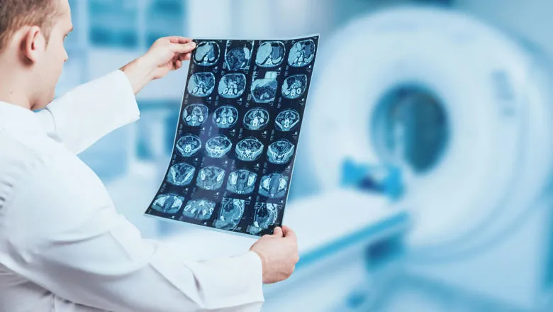 autoprostate