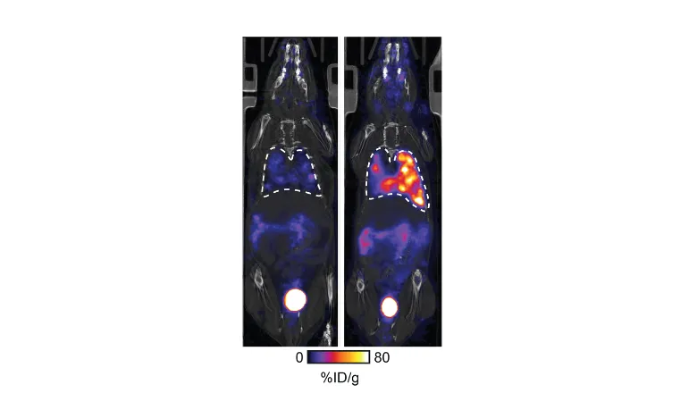 scans of cancer tumours resistant to treatment 