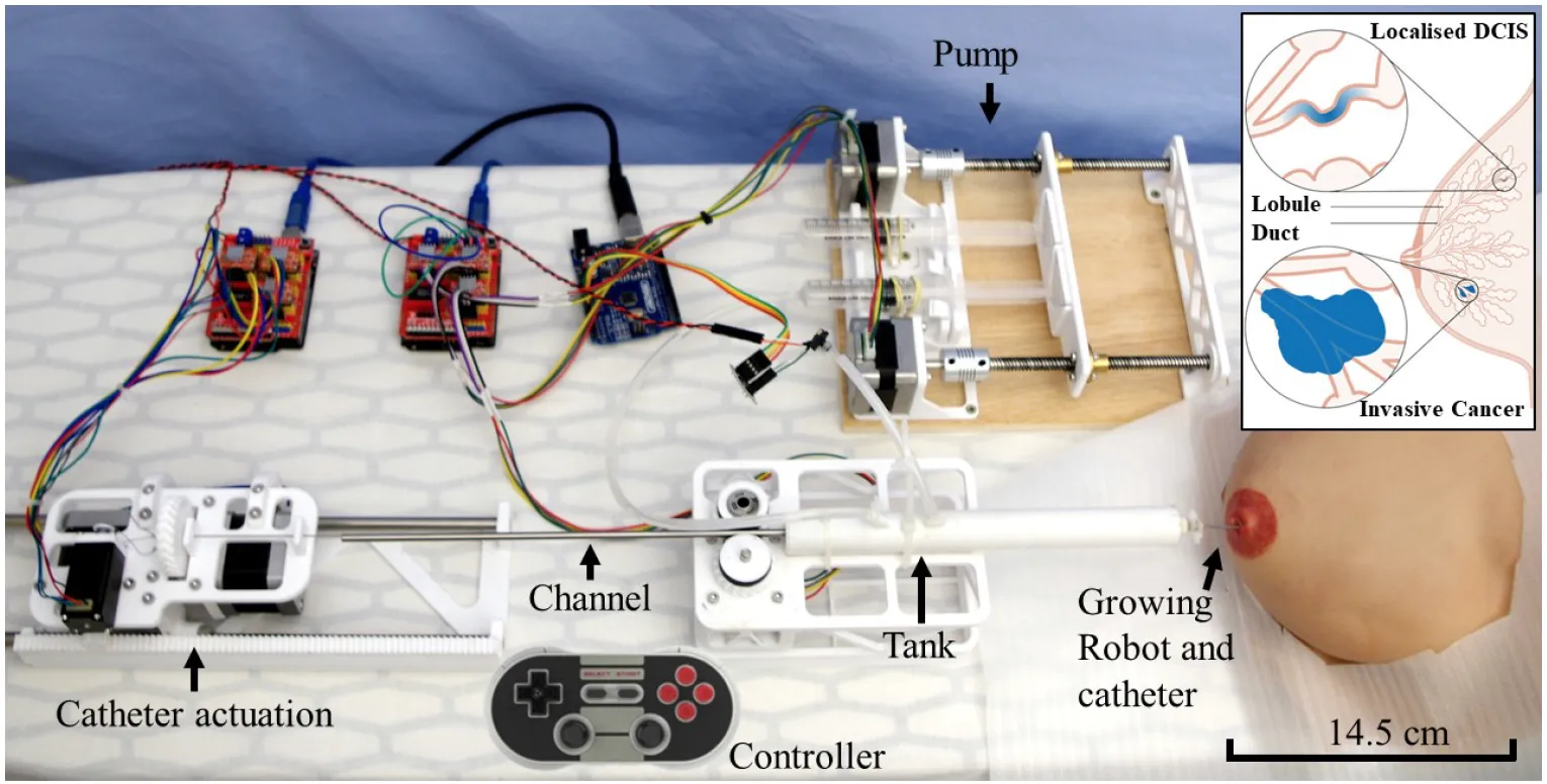 MAMMOBOT: the system comprises a growing robot and a steerable catheter to navigate inside the mammary ducts network simulated by a breast phantom. The growing robot’s internal pressure is controlled, and teleoperation is done with a gamepad controller. Inlet: Mammary duct tree network and
localised ductal carcinoma in situ. Credit: Cancer Research UK.