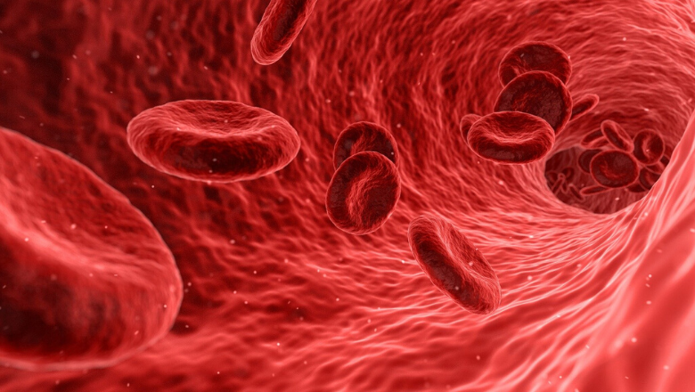 sickle cell blood