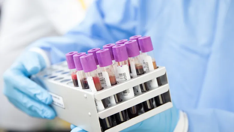 A laboratory professional in a lab coat is holding a box containing various blood samples for analysis.