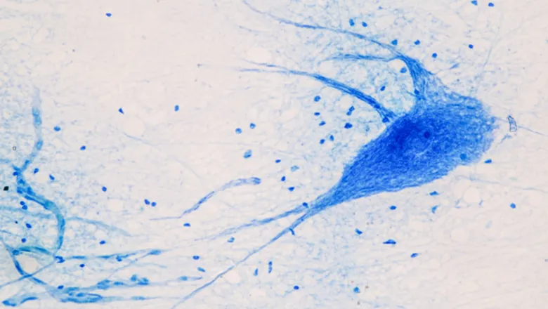 Motor Neuron Disease article 29-08-23 780x450