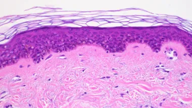 Skin tissue thumbnail 780 × 440 px
