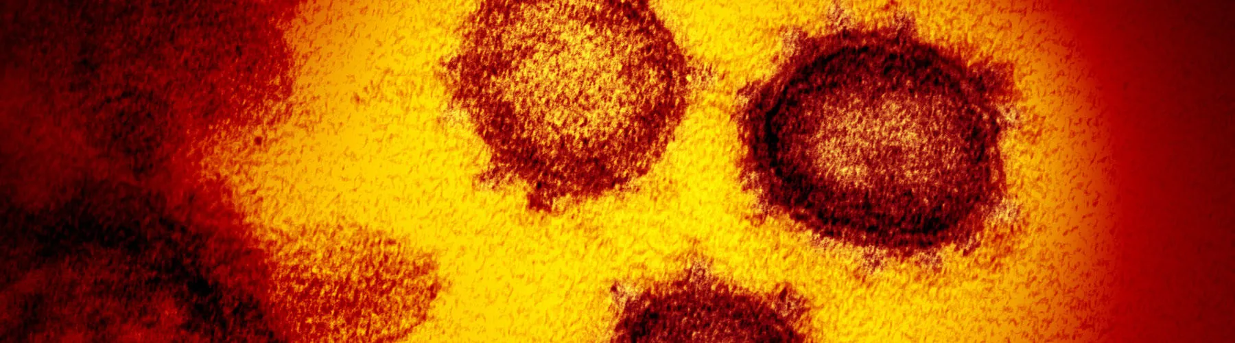 Red and yellow visualisation of the novel coronavirus