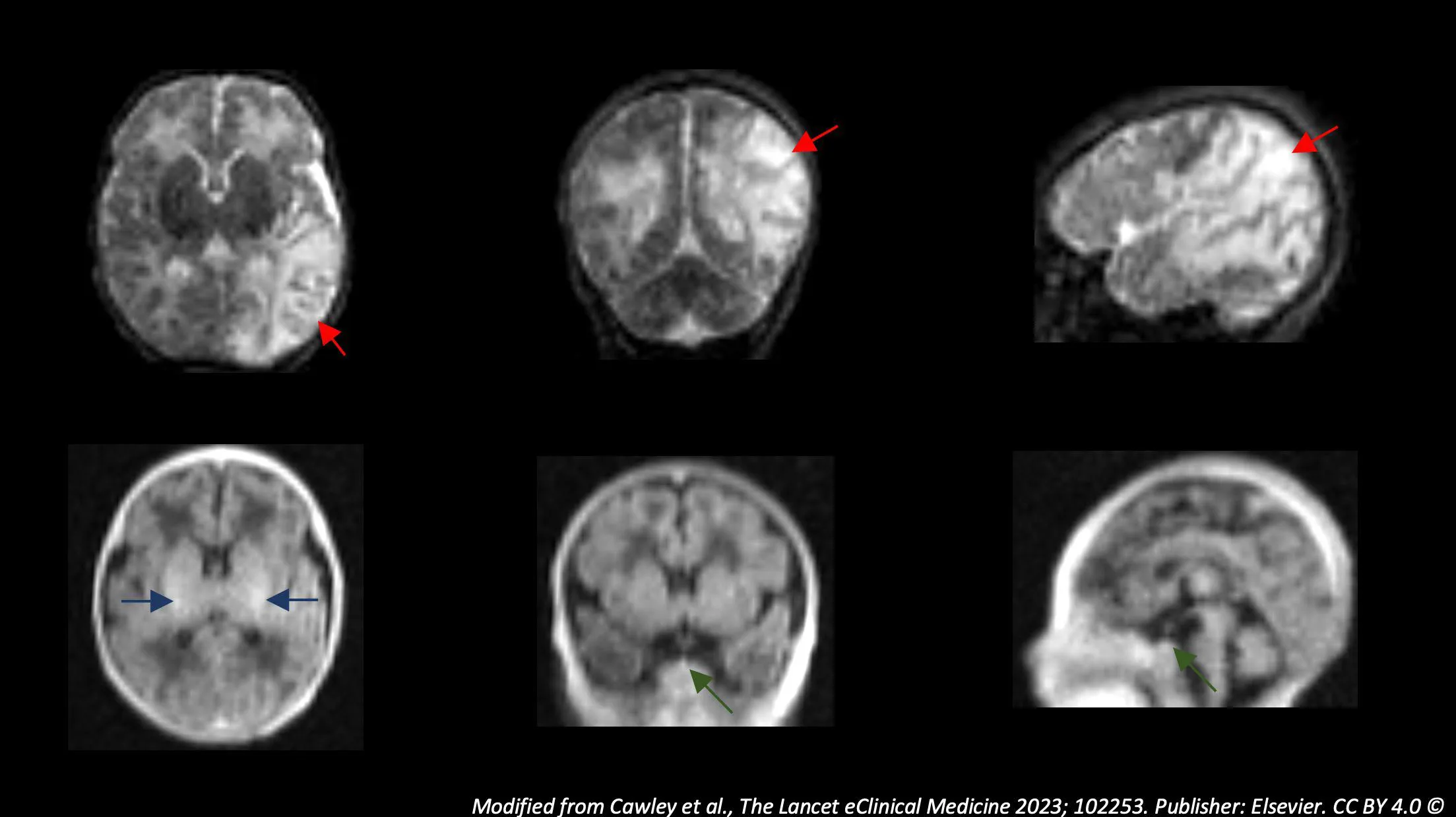 Portable MRI (1)