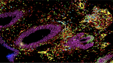 Cutaneous Autoimmunity Group