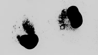 VACV DAPI Basant Lab Hero