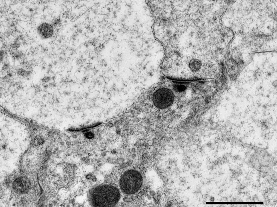 Inner hair cell ribbon synapses in cochlear tissue