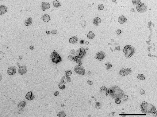 Negatively stained exosomes