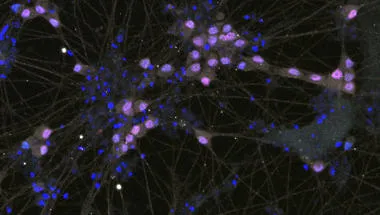 Lab grown neurons1